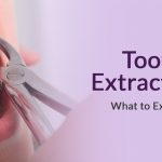 Tooth Extraction - dental surgery in Wallington