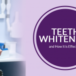 Teeth Whitening and How it is Effective