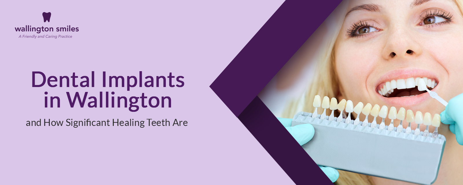 Dental Implants in Wallington